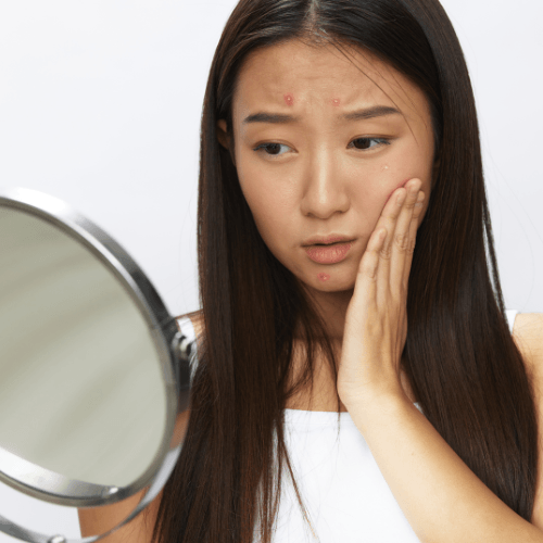 Is Stress Showing on Your Face? Discover the Physical Signs and How to Heal Naturally! 🧘♀️✨ - Happiness Harmony Hub