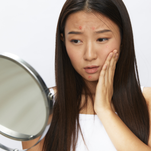 Is Stress Showing on Your Face? Discover the Physical Signs and How to Heal Naturally! 🧘‍♀️✨